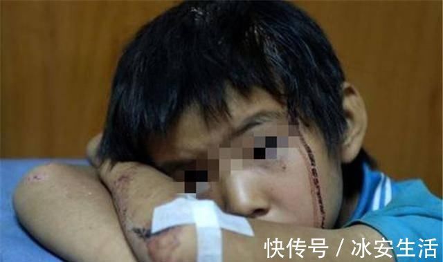 玩耍|1岁孩童玩耍被推倒,哭了几声爬起来继续玩,第二天却闭上了眼