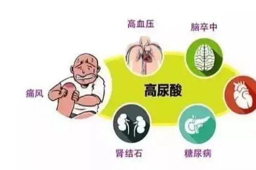 睡觉时,身体有3种表现,十有八九尿酸已“超标”,不要忽视