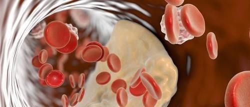 血管|血脂高百病来!家中备1物,泡水喝,血脂降、血管通,脑梗不发作