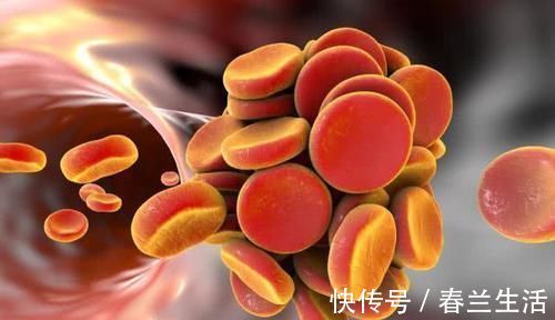 mg|血脂高血液稠的人,少碰“2白”,多吃“3红”远3事,赶走血栓