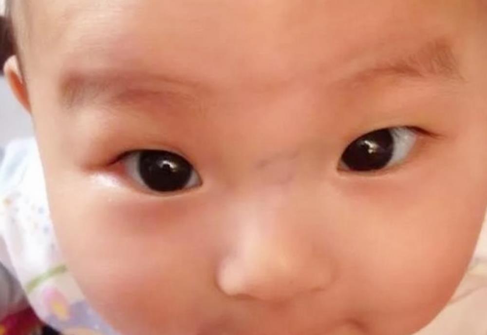 宝宝|孕期常吃几种水果，宝宝的鼻子会“更挺、更高”，孕妈别错过