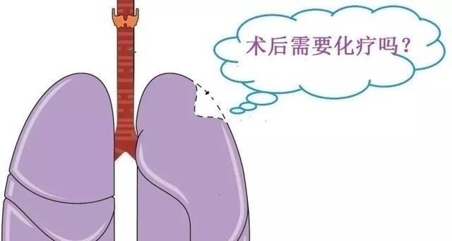 肿瘤|原来有些癌症根本不需要化疗，反而会起到相反的效果，你中招了吗