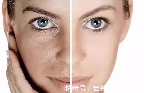 科普 其实你皮肤并不黑,只是发黄暗沉|医美科普!