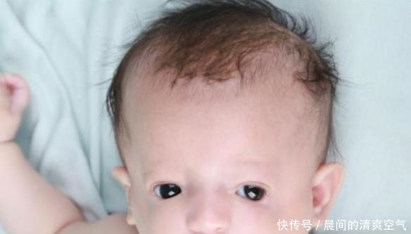 缺陷|女子天生“鸟脸”,却非要生二胎,网友:躲得过初一,躲不了十五