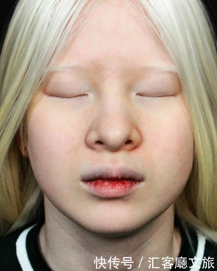 逆袭|因“全身雪白”被遗弃的中国女孩,逆袭成超模的故事让人泪目