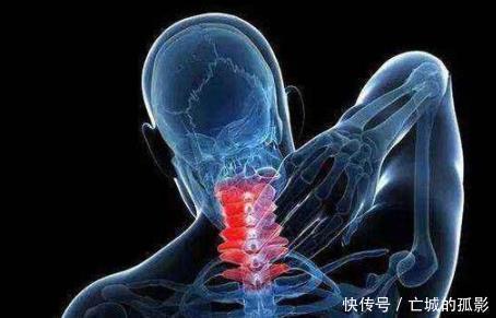 木瓜|颈椎差的人,多揉3个穴位,多吃3物,舒经活络、身体“轻如飞燕”