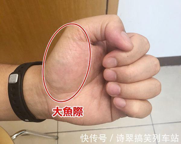 紫菜|血糖高不高,看双手就懂?若有这4种症状,或在暗示血糖偏高了