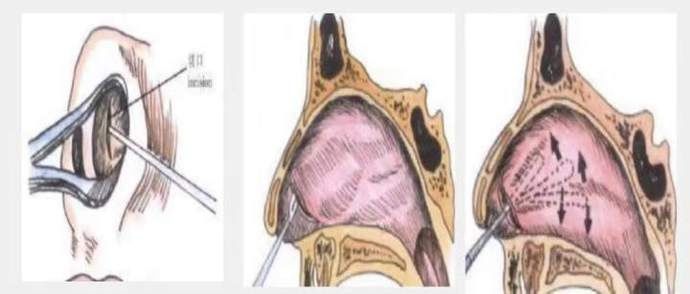 浙江省立同德医院|40多岁大姐外貌却像饱经风霜的老农， 原来是脑袋里长了肿瘤