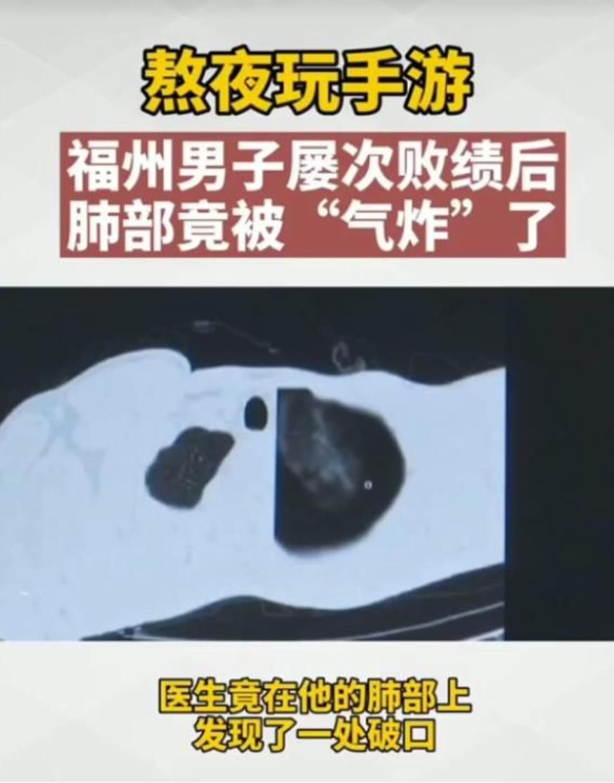 记住|严重伤“肺”的英雄已公布！记住这4个英雄，就算瘾再大，也别碰