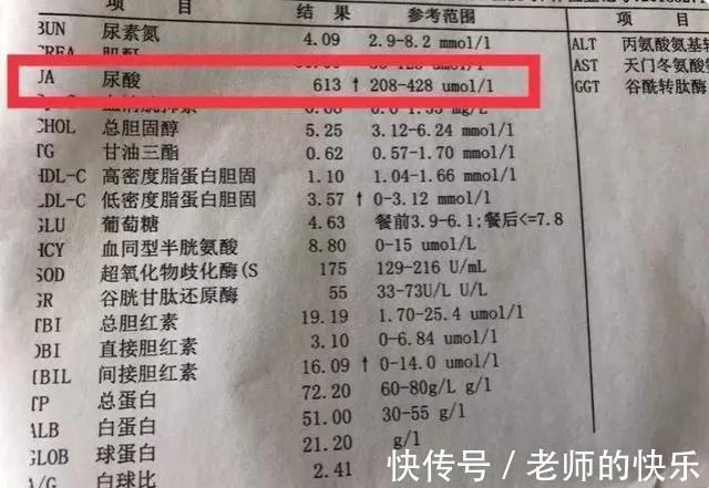 苏打饼干|高尿酸患者,医生提醒:常吃3种碱性食物,或可稳定尿酸