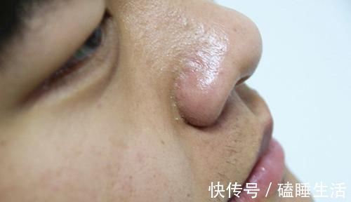 异常|肝癌不会突然发生！医生：身体会给3次机会，若不抓住，后悔莫及