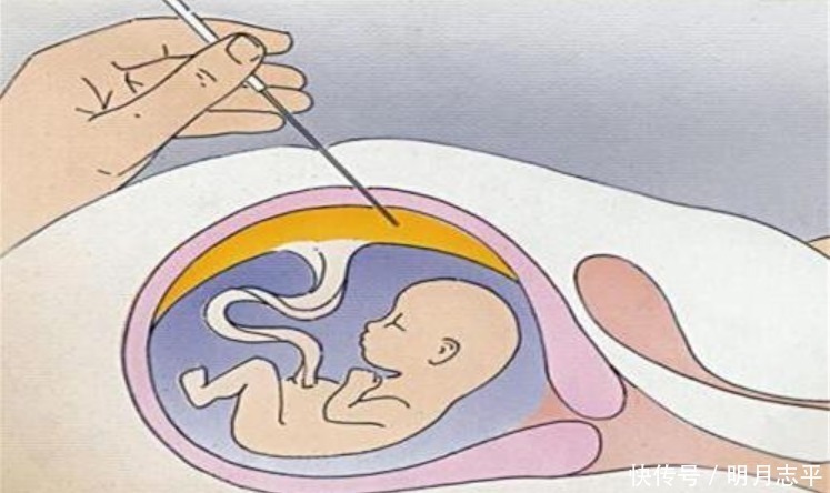 羊水|孕期羊水浑浊容易伤宝宝！做到4不碰，可让羊水保持清澈！