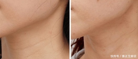 使用爽肤水时倒手上就开始拍？医生都哭笑不得：果然是人傻钱多！