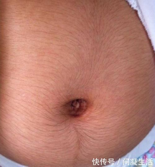 妈妈们|肚子长毛、有黑线？怀孕后肚子的这几点变化最明显