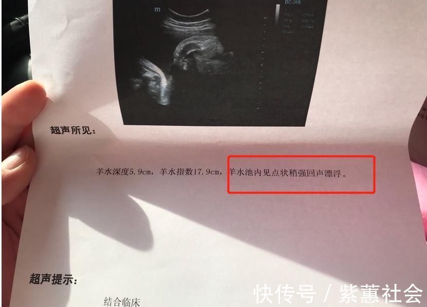 妊娠|怀孕后，4个“不良习惯”可能会让羊水变浑浊，孕妈别大意