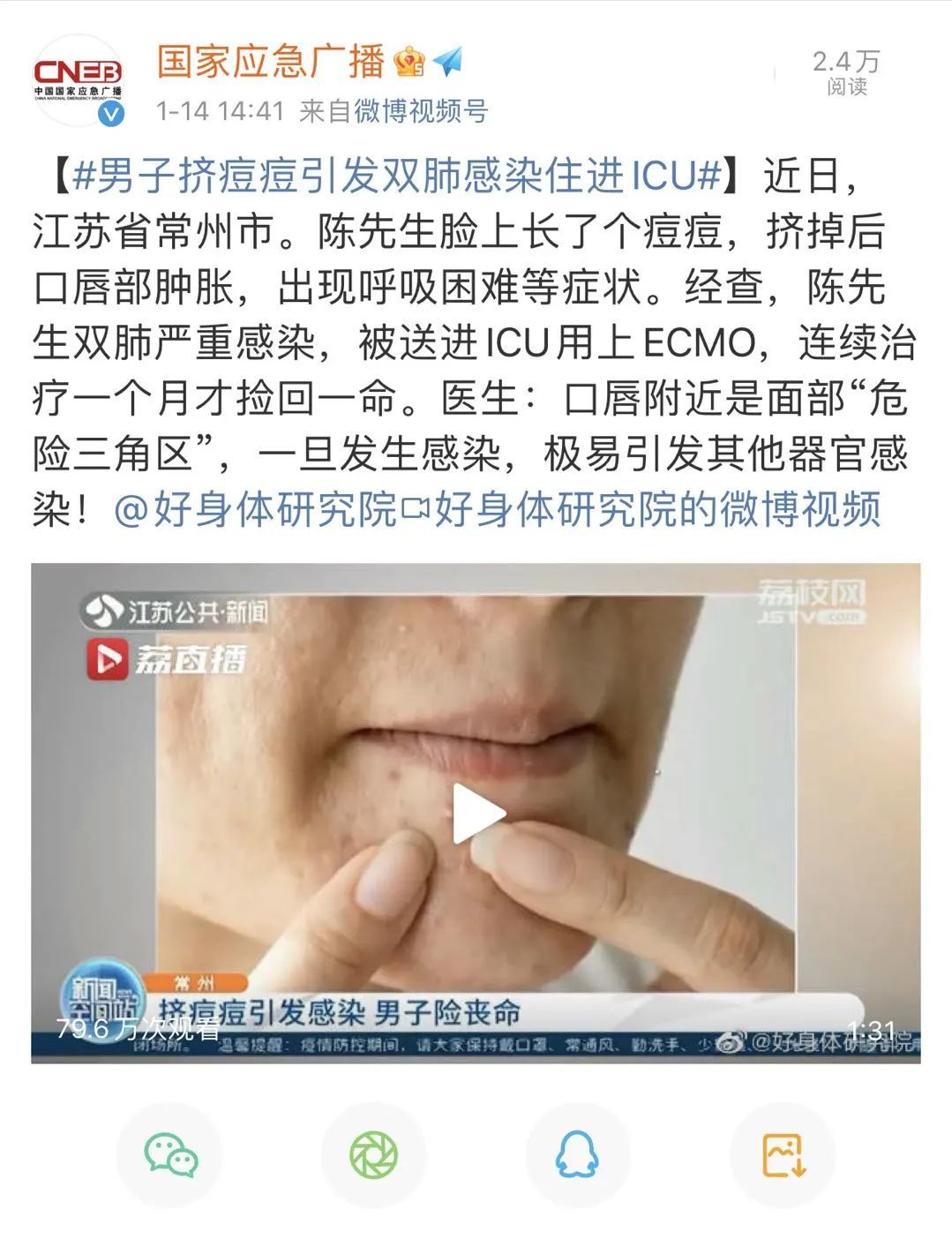 静脉瓣|他挤了一下脸上的痘痘，差点没了命