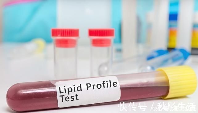 甘油三酯|甘油三酯升高,身体有哪些异常表现?如何预防?医生来讲解