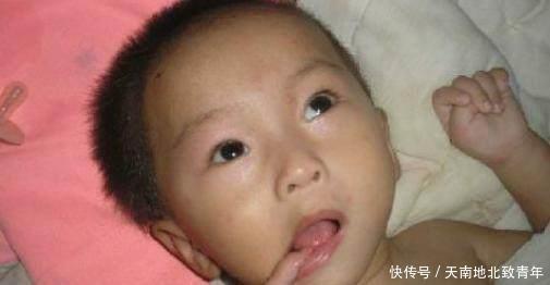 大意|新生儿有这几种表现,可能是患上了脑瘫,做父母的不能大意!
