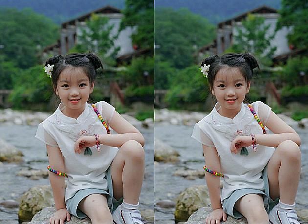 禁止整容|曾經被全網“禁止整容”的阿拉蕾,如今變成這副模樣,美到不敢認