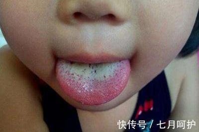 儿科医生|吃一口相当于吃5斤山药,儿科医生:娃不妨多吃,脾胃好或多长个