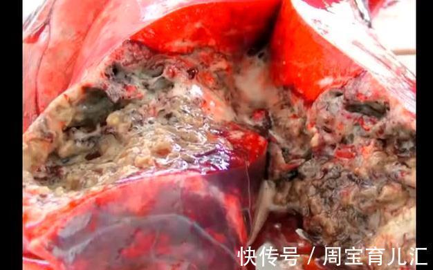 心血管疾病|肺部不健康不能吃茄子?多吃5种食物,滋养肺部,身体更轻松