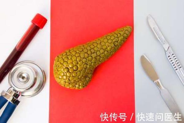 胰腺癌被称为“癌王”,早期发现胰腺癌,对治疗有重大意义