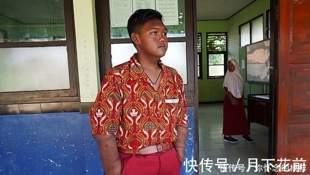 小孩|近400斤的“世界最胖小孩”减肥成功,如今他这样了!