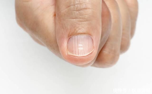 这4个部位出现异常,或许是肝脏受损了,建议查一下肝功能!
