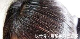 微血管|经络不通百病生,一套从头练到脚的经络养生操,手把手教会您