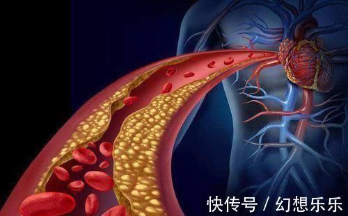 麻木感|血液粘稠的人,可能有4个症状,若你一个没有,恭喜血管挺干净