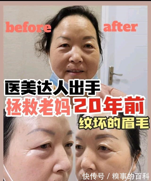 纹绣师 医美达人出手,拯救老妈20年前纹坏的眉毛!