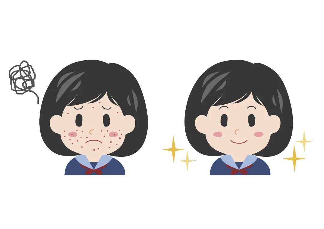 水杨酸|问：换季皮肤不适时该用些什么？