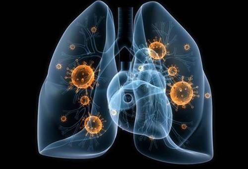 辣椒|肺结节患者不能吃辣椒?医生:要想肺部安稳,3种食物可多吃