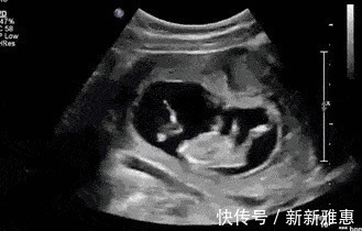 身体|怀孕后,不只是肚子会变大,孕妈身体的这些地方,也会有不同变化