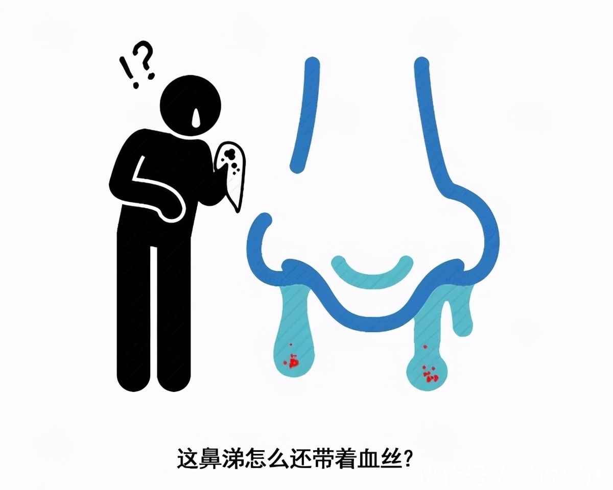 出血|经常喝酒的人要注意了!若出现这3种迹象,或许肝脏可能“崩溃”