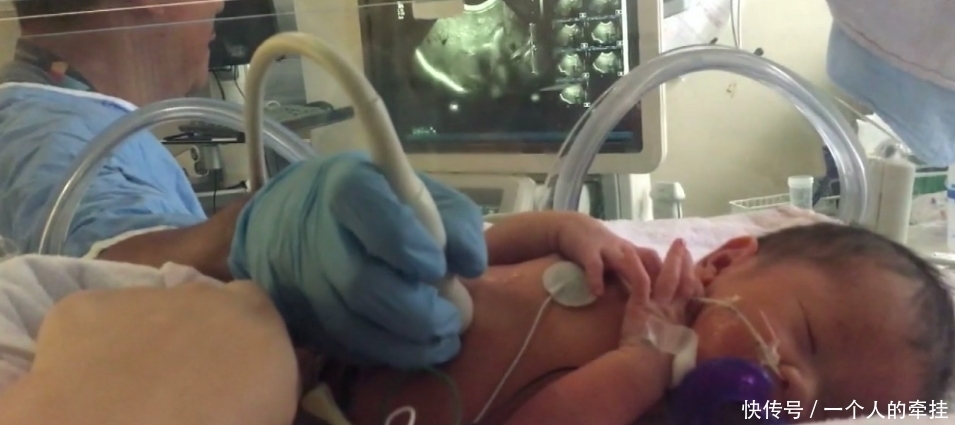 接受|加拿大首例:宝宝 在妈妈肚子里接受手术