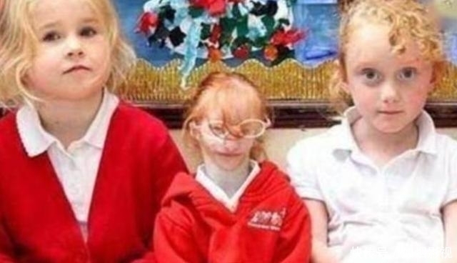 孩子|女孩出生仅1斤“轰动世界”,如今14年过去,结果出现反转