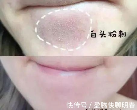 薇娅|能让李佳琦和薇娅看得上,这韩国去角质凝胶,实力真的很强大