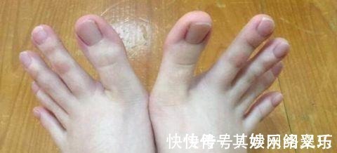 小李|32岁男子不抽烟、不喝酒癌症离世, 医生 1个习惯害的!