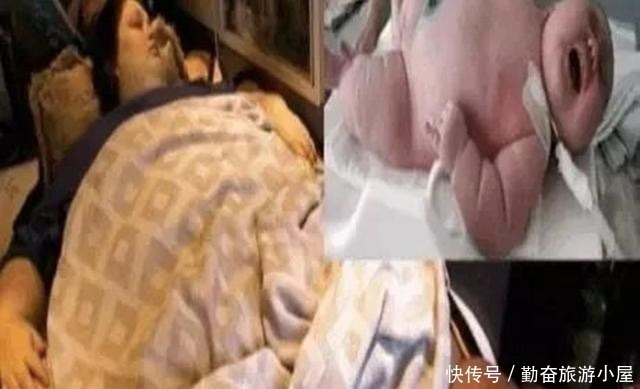 新生儿|500斤孕妇进医院成功顺产,母子平安,丈夫看到宝宝后却愣在原地