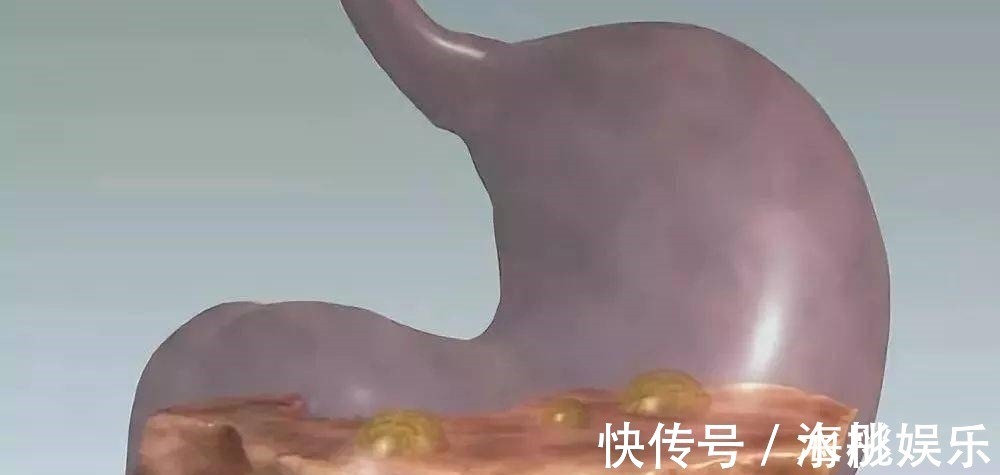 结石|胃功能不好的人,3物紧着吃,若坚持,胃不疼,胃病绕着走