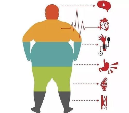 手术|切掉大半个胃，只为了治疗糖尿病？减重手术治疗糖尿病可靠吗？