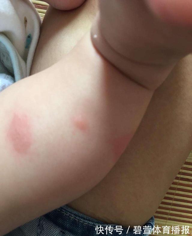 蚊子|为什么有钱人在卧室门贴个“创可贴”?听内行一说,后悔没早知道