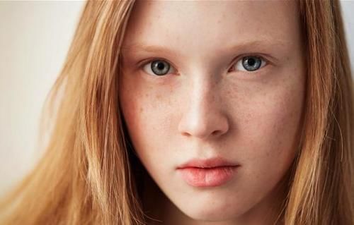 斑是怎么长出来的，想要祛斑，这些原因要清楚