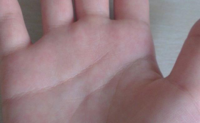 燕麦|你清楚“糖尿病”吗？如何降“血糖”？建议：常吃以下这5种食物