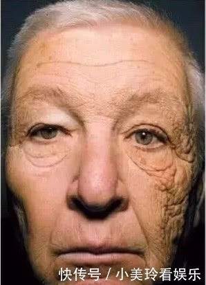 生活习惯|为什么会出现“抬头纹”?主要是这3大原因,别说你还不知道