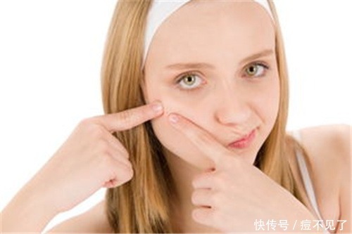 痘博士指出,寒冬里这样祛痘印,效果甚佳