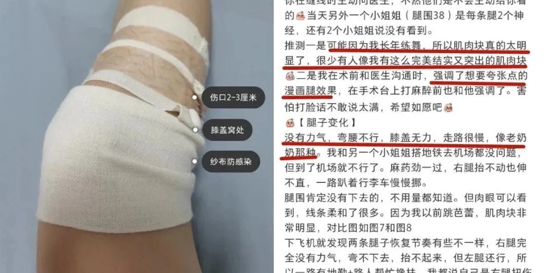 手术|又一个被“自残式整容”手术毁掉的中国女孩，好可怕...