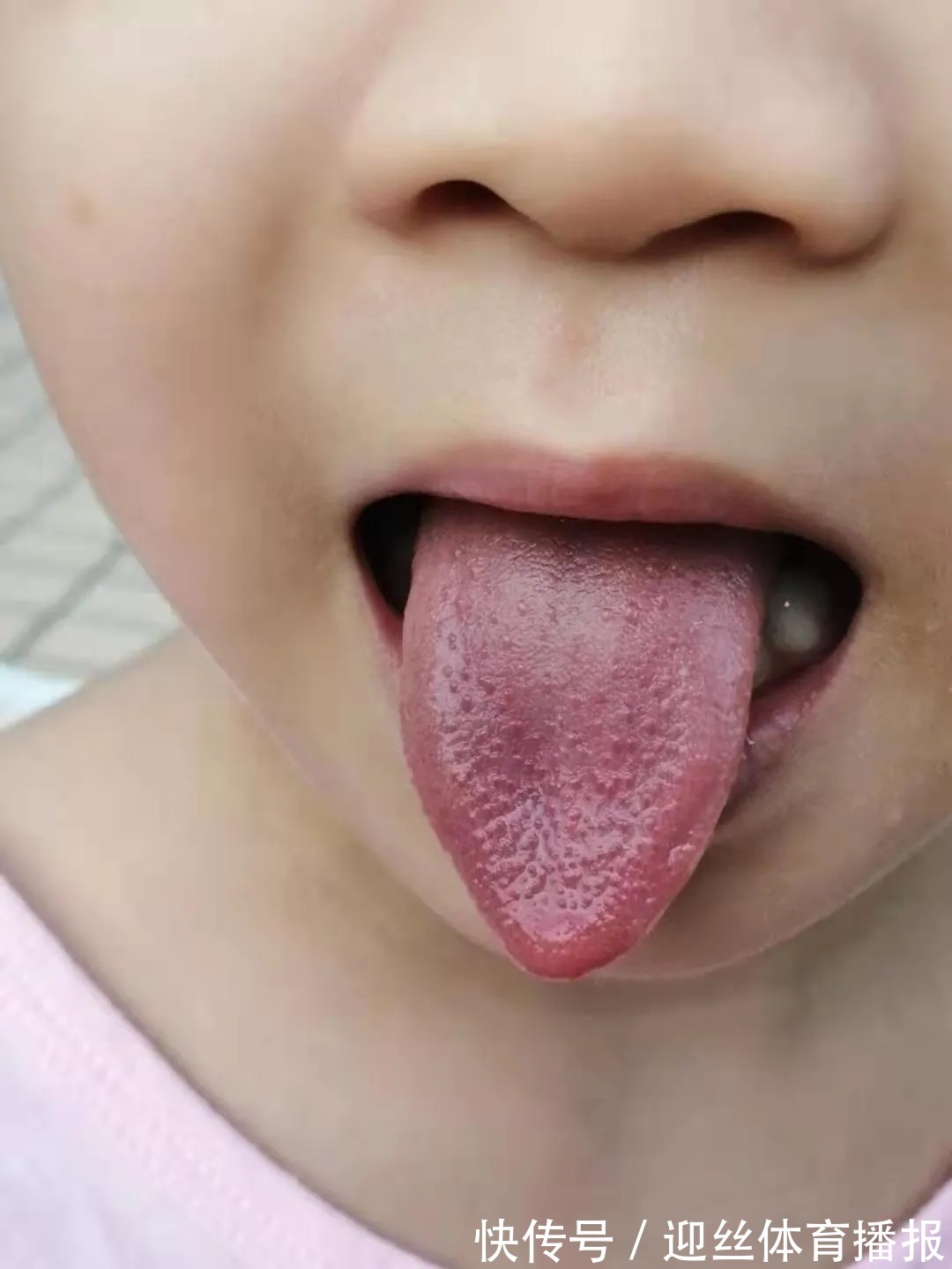 肝气不舒|孩子总拉羊屎蛋、总便秘,用食疗给肠道补点津液