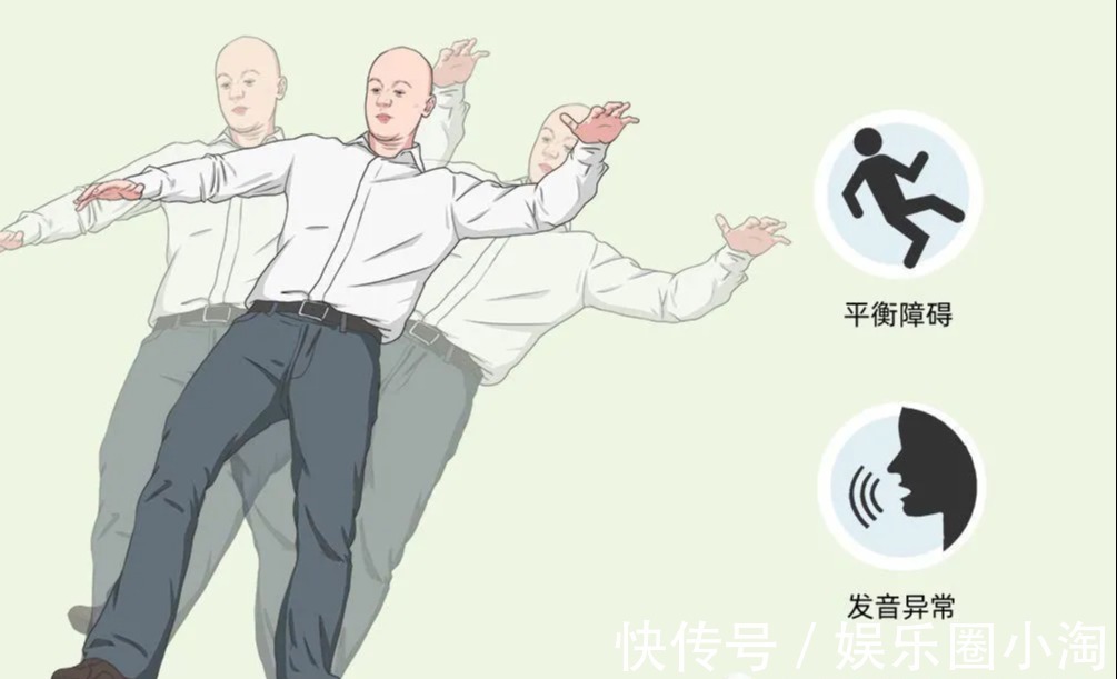 輕度|輕度小腦萎縮會有哪些癥狀！